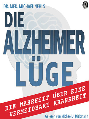 cover image of Die Alzheimer Lüge